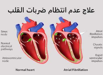 علاج أورام المخ